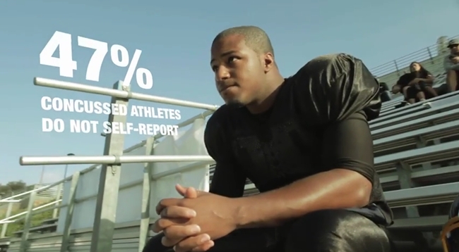 concussion detection