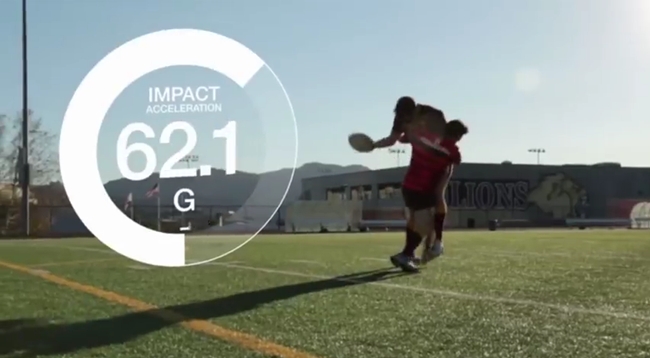 concussion detection